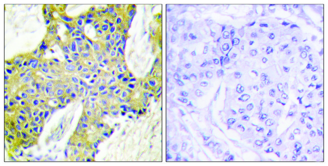 Anti-IARS2 antibody produced in rabbit