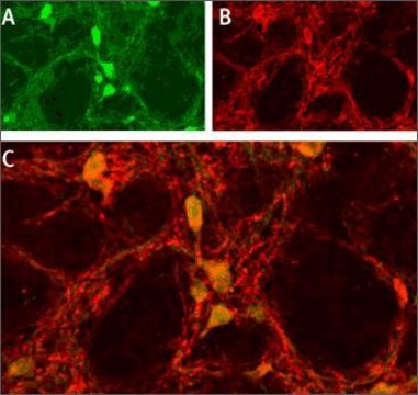Anti-Sodium Channel ASIC1 antibody produced