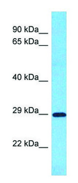 Anti-SLC25A35 antibody produced in rabbit