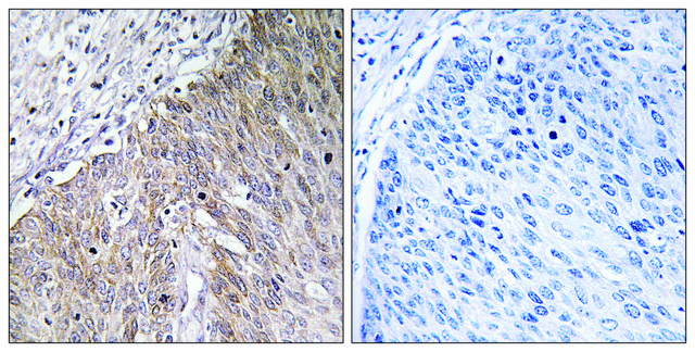 Anti-APOL2 antibody produced in rabbit