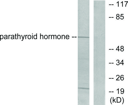 Anti-Parathyroid Hormone antibody produced in