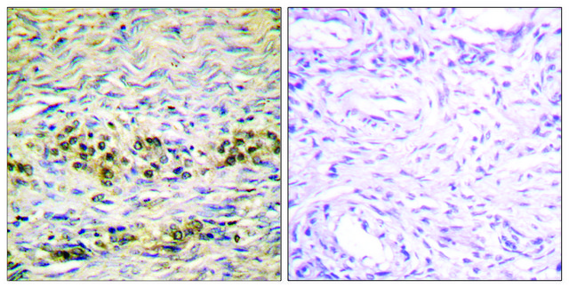 Anti-AKT antibody produced in rabbit