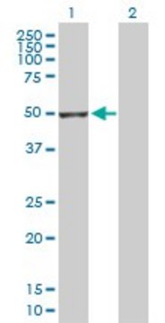 Anti-GSDMDC1 antibody produced in rabbit