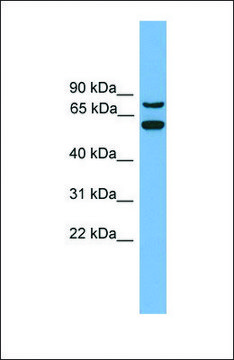 Anti-YY1AP1 antibody produced in rabbit