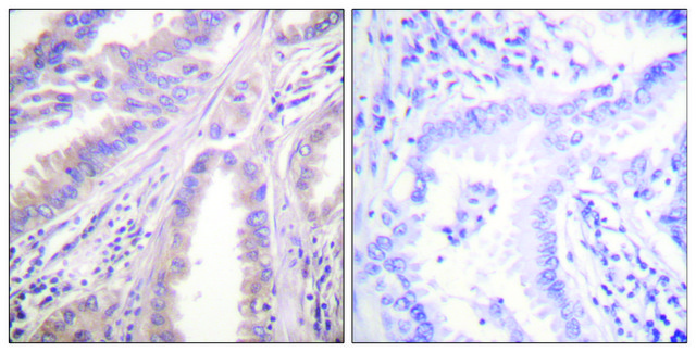Anti-KIF11 antibody produced in rabbit