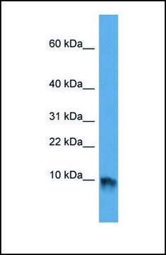 Anti-EGF antibody produced in rabbit