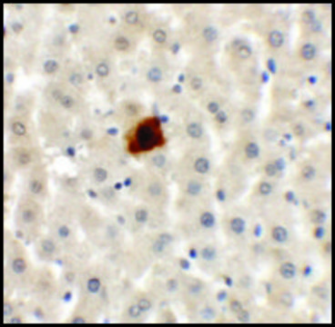 Anti-EI24 antibody produced in rabbit