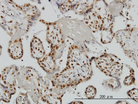Monoclonal Anti-ZNF265 antibody produced in