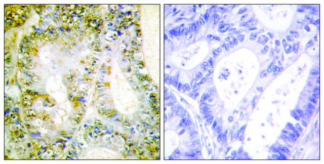 Anti-Catenin-?1 antibody produced in rabbit