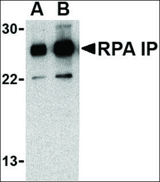 Anti-RPA Interacting Protein (ab2) antibody