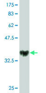 Monoclonal Anti-NOVA1, (C-terminal) antibody produced