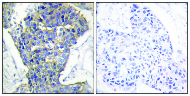 Anti-MUNC-18A antibody produced in rabbit