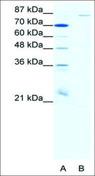 Anti-MEFV antibody produced in rabbit