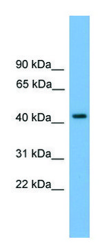 Anti-PALM (N-terminal) antibody produced in