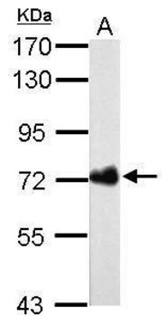 Monoclonal Anti-Urease B antibody produced