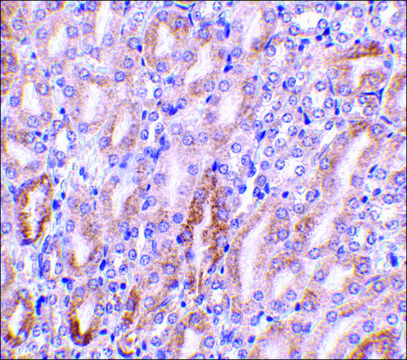 Anti-CAD (ab2) antibody produced in