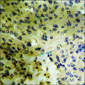 Anti-phospho-BLNK (pTyr??) antibody produced in