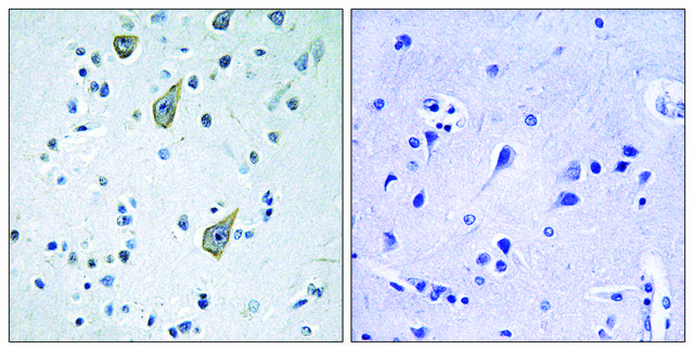 Anti-FZD6 antibody produced in rabbit
