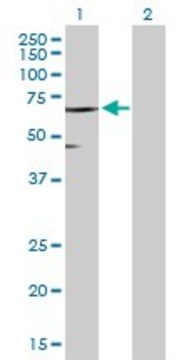 Anti-SLC45A2 antibody produced in rabbit