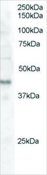 Anti-Dysadherin antibody produced in goat