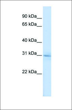 Anti-METTL5 antibody produced in rabbit