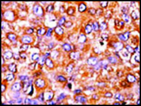Anti-Phospho-MYT1-T495 antibody produced in rabbit