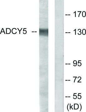 Anti-ADCY5, C-Terminal antibody produced in
