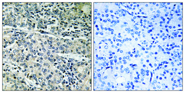 Anti-MP68 antibody produced in rabbit
