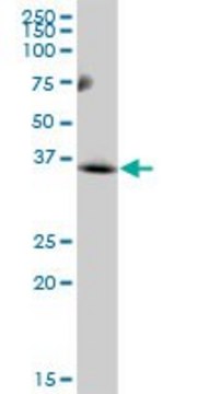 Anti-MCART1 antibody produced in mouse