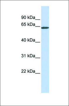 Anti-ANTXR1 antibody produced in rabbit