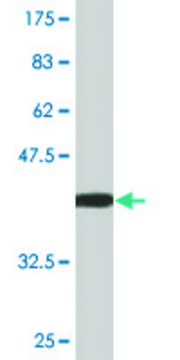 Monoclonal Anti-LATS1 antibody produced in