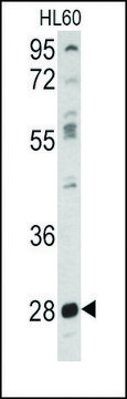 Anti-PKMYT1 (center) antibody produced in