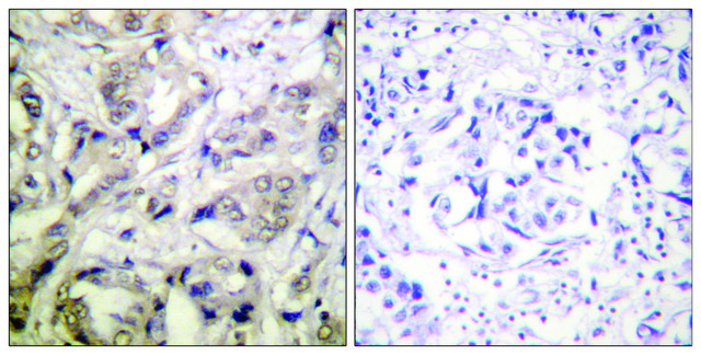 Anti-CAMK1-? antibody produced in rabbit