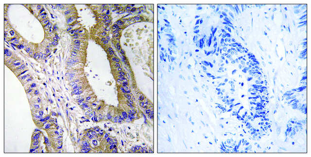 Anti-STK24 antibody produced in rabbit
