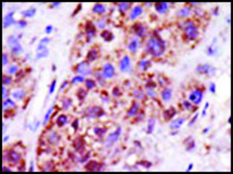 Anti-UBCE7IP5 (center) antibody produced in