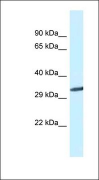 Anti-GNMT antibody produced in rabbit