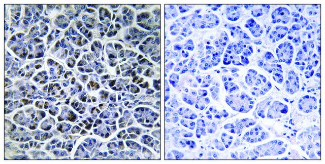 Anti-PPM1K antibody produced in rabbit