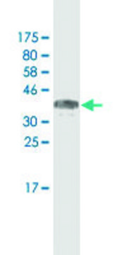 Monoclonal Anti-MACF1, (N-terminal) antibody produced