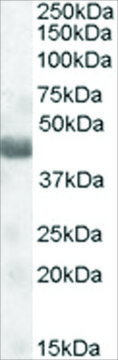 Anti-TUSC4/NPRL2 (AA 140-151) antibody produced