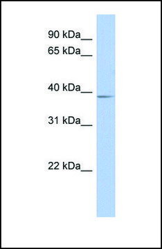 Anti-SLC25A28 antibody produced in rabbit
