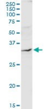 Anti-QPRT antibody produced in rabbit