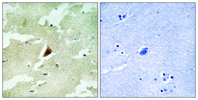 Anti-MAPKAPK5 antibody produced in rabbit