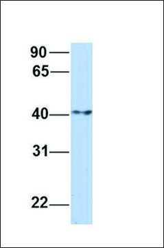 Anti-ERLIN1 antibody produced in rabbit