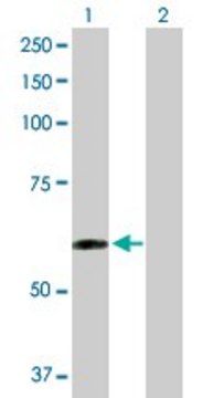 Anti-TAPBPL antibody produced in rabbit