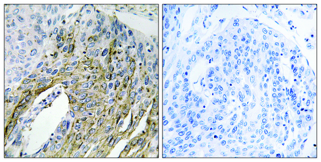 Anti-LONP2 antibody produced in rabbit