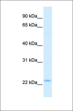 Anti-REEP1 (ab2) antibody produced in