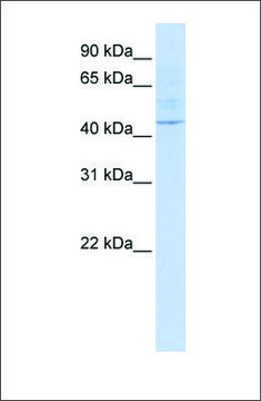 Anti-LAX1 antibody produced in rabbit
