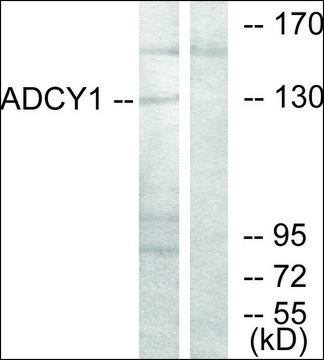 Anti-ADCY1 antibody produced in rabbit