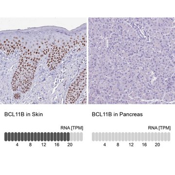 Anti-BCL11B antibody produced in rabbit