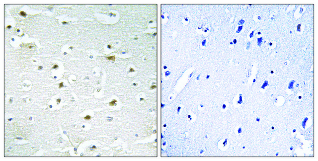 Anti-DDX3Y antibody produced in rabbit